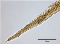 Philonotis mollis (Dozy et Molk.) Mitt. Collection Image, Figure 9, Total 20 Figures